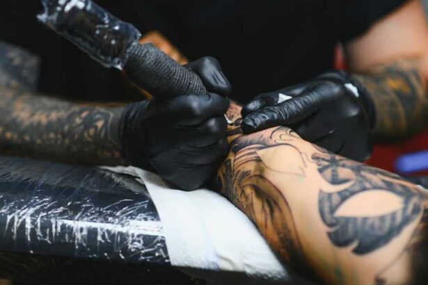 Tattoo Removal for Sensitive Skin: What You Need to Know
